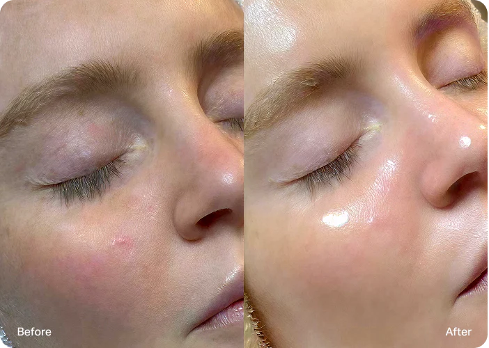 Glow & fahle Haut
